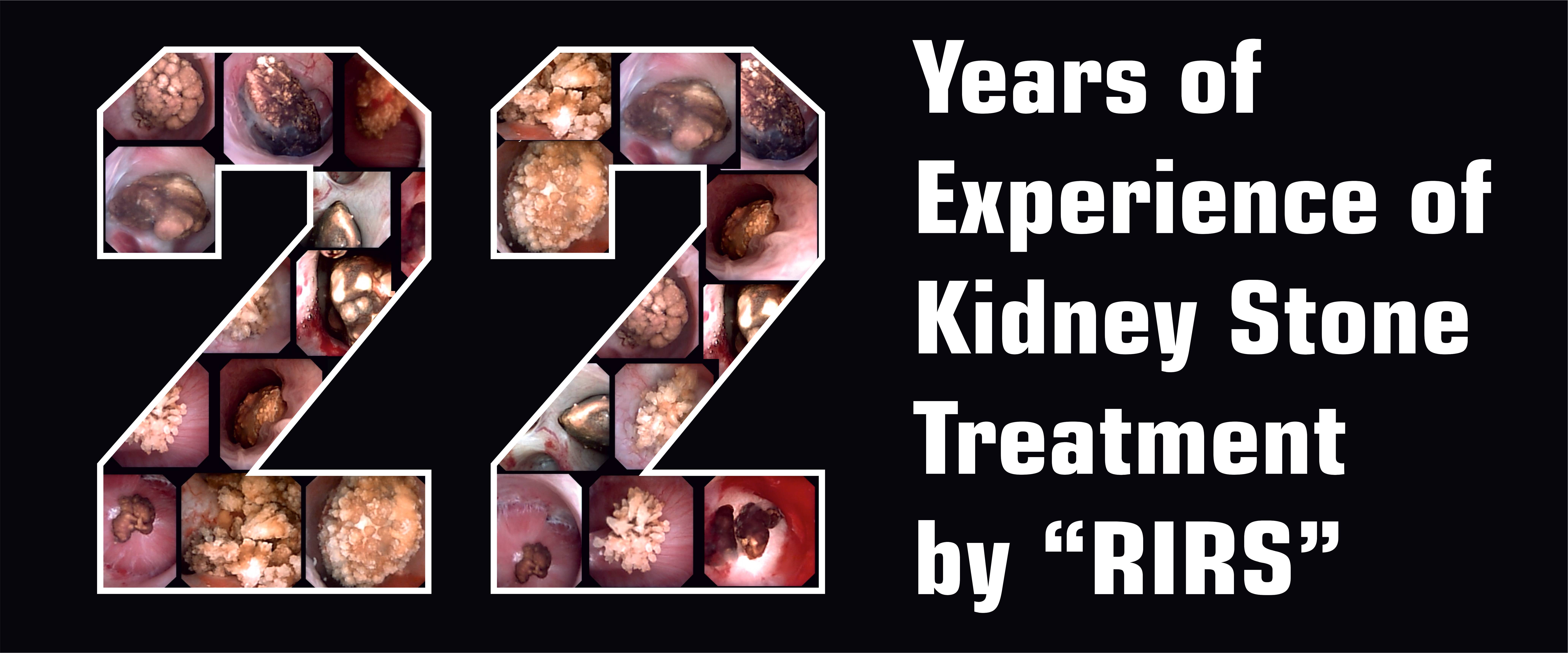 22 Years of Kidney Stone Treatment