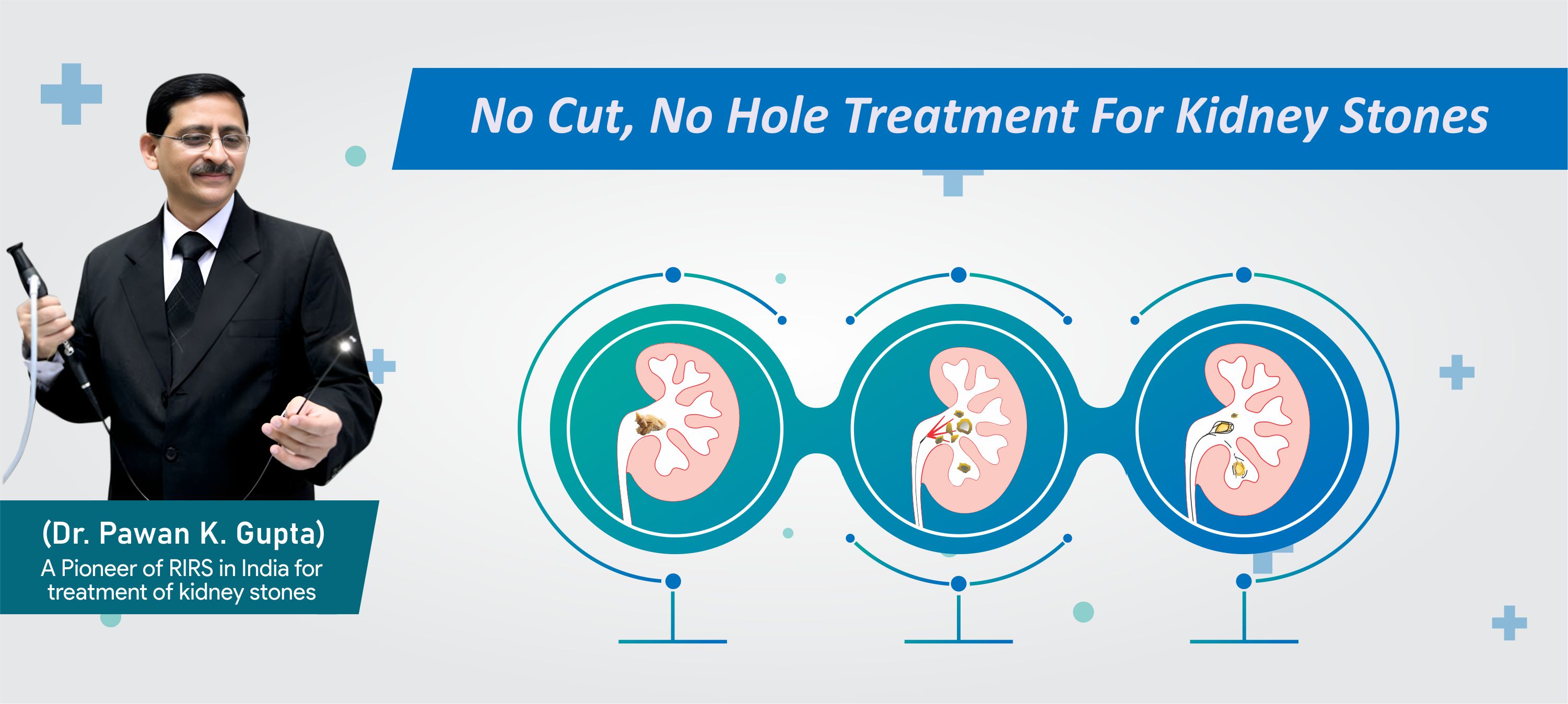 no-cut-no-hole-treatment-for-kidney-stones
